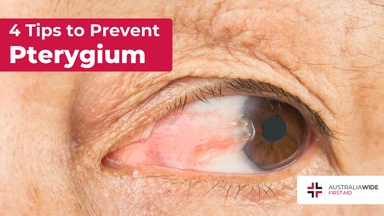 Prevent pterygium article header – First Aid Article in Beaudesert